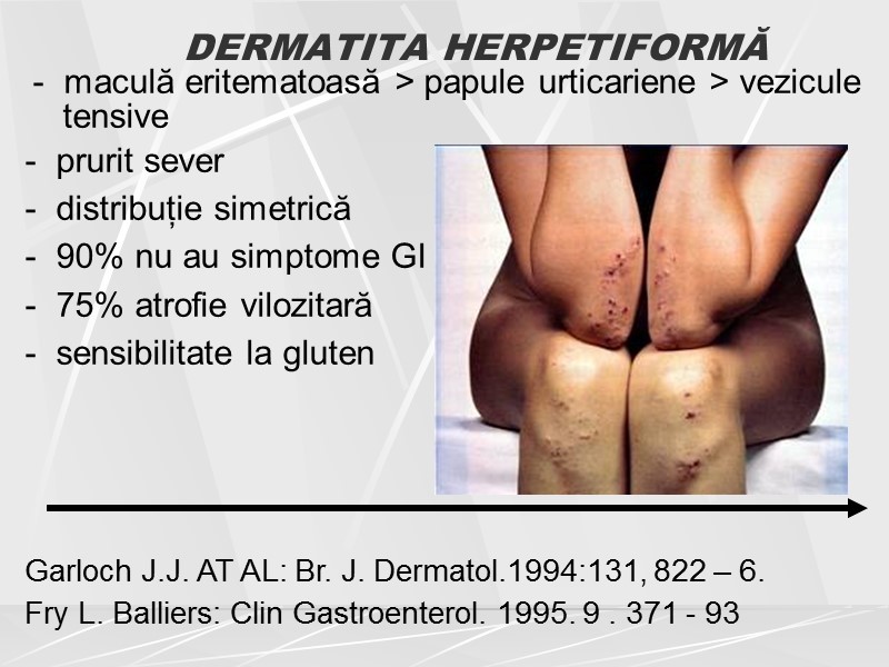DERMATITA HERPETIFORMĂ